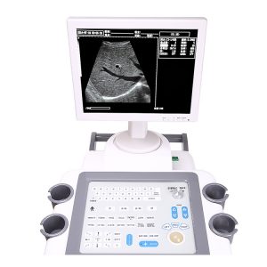 news Ultrasound machine