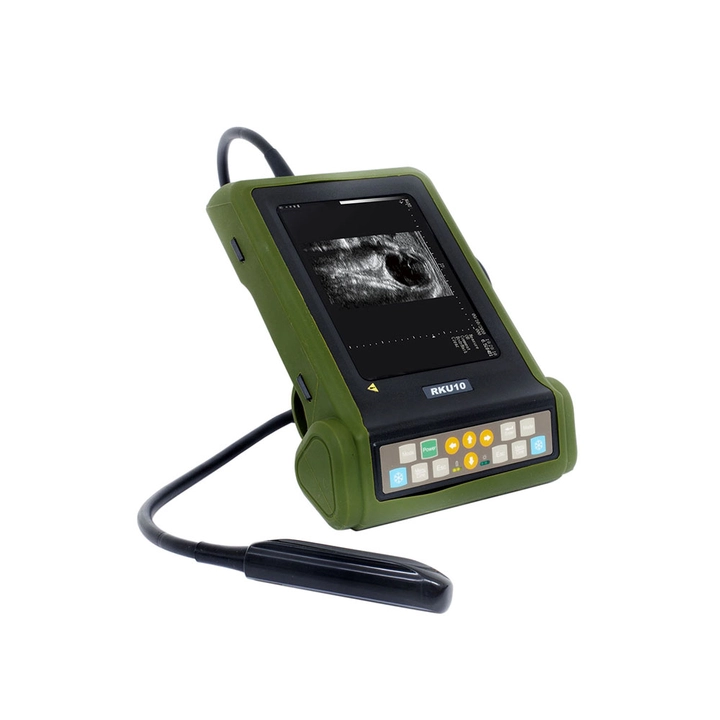 cardiac ultrasound Machine