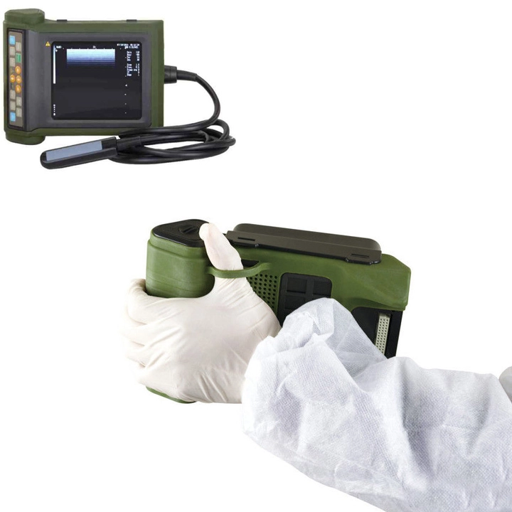 cardiac ultrasound machine